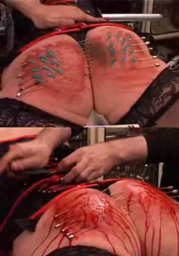 Bloody ass in extreme BDSM.
