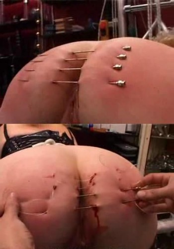 Severe pain in the ass or a huge needle